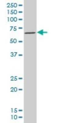 Western Blot: MEF2A Antibody (1F8) [H00004205-M08]