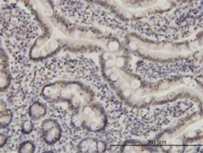 Immunohistochemistry-Paraffin: MEF2A Antibody (3F6) [H00004205-M01]