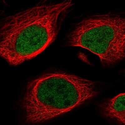 Immunocytochemistry/ Immunofluorescence: MEF2A Antibody [NBP2-58539]