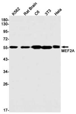 Western Blot: MEF2A Antibody (S04-2C8) [NBP3-14953]