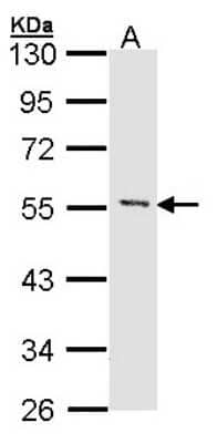 Western Blot: MEF2A Antibody [NBP1-32268]