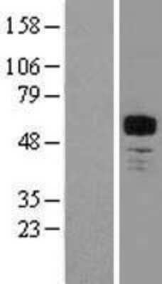 Western Blot: MEF2A Overexpression Lysate [NBL1-12998]