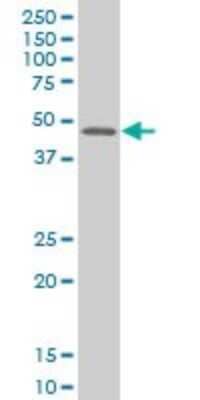 Western Blot: MEF2B Antibody (4B5) [H00004207-M24]