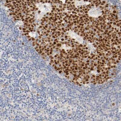 Immunohistochemistry-Paraffin: MEF2B Antibody [NBP1-93440]