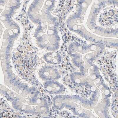 Immunohistochemistry-Paraffin: MEF2B Antibody [NBP1-93440]