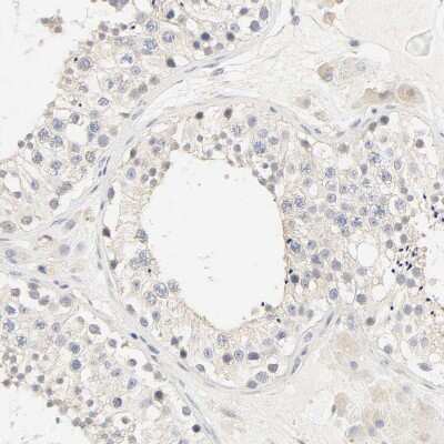 Immunohistochemistry-Paraffin: MEF2B Antibody [NBP1-93440]