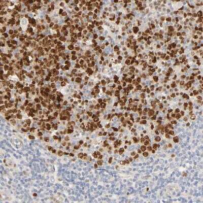 Immunohistochemistry-Paraffin: MEF2B Antibody [NBP1-93440]