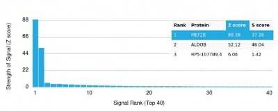 Protein Array: MEF2B Antibody (PCRP-MEF2B-2F9) [NBP3-13825]