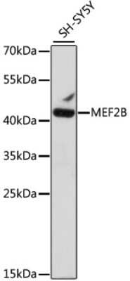 Western Blot: MEF2B AntibodyAzide and BSA Free [NBP3-03919]