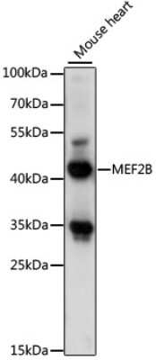 Western Blot: MEF2B AntibodyAzide and BSA Free [NBP3-03920]