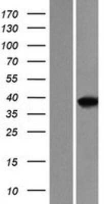 Western Blot: MEF2B Overexpression Lysate [NBP2-10438]