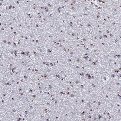 Immunohistochemistry-Paraffin: MEF2BNB Antibody [NBP2-47380]