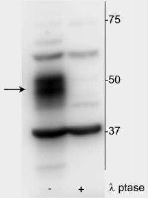 Western Blot: MEF2C [p Ser222] Antibody [NBP2-60774]