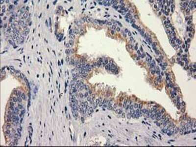 Immunohistochemistry-Paraffin: MEF2C Antibody (OTI1H5) [NBP2-00493]
