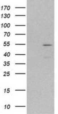 Western Blot: MEF2C Antibody (OTI1H5) [NBP2-00493]