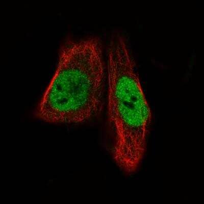 Immunocytochemistry/ Immunofluorescence: MEF2C Antibody (CL0368) [NBP2-52925]