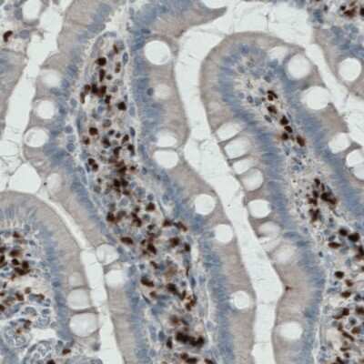 Immunohistochemistry: MEF2C Antibody (CL0368) [NBP2-52925]
