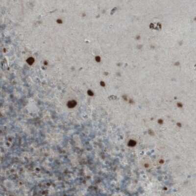 Immunohistochemistry-Paraffin: MEF2C Antibody (CL0368) [NBP2-52925]