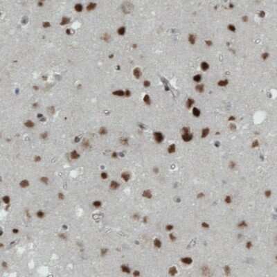 Immunohistochemistry-Paraffin: MEF2C Antibody (CL0368) [NBP2-52925]