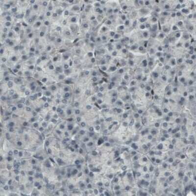 Immunohistochemistry-Paraffin: MEF2C Antibody (CL0368) [NBP2-52925]