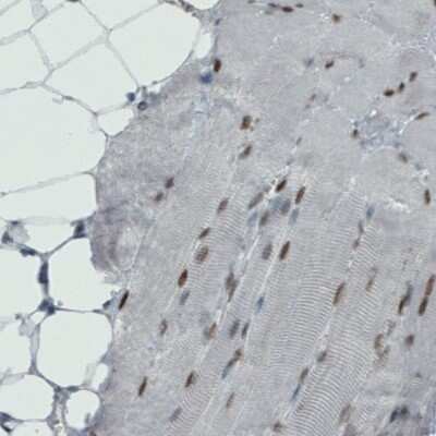 Immunohistochemistry-Paraffin: MEF2C Antibody (CL0368) [NBP2-52925]