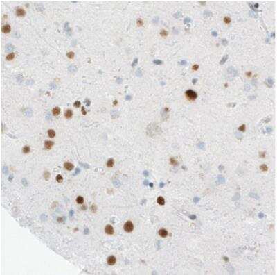 Immunohistochemistry: MEF2C Antibody (CL0369) [NBP2-30671]