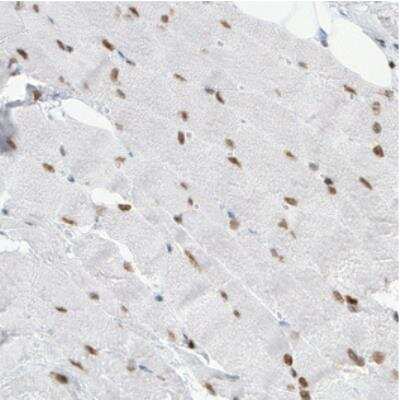 Immunohistochemistry: MEF2C Antibody (CL0369) [NBP2-30671]