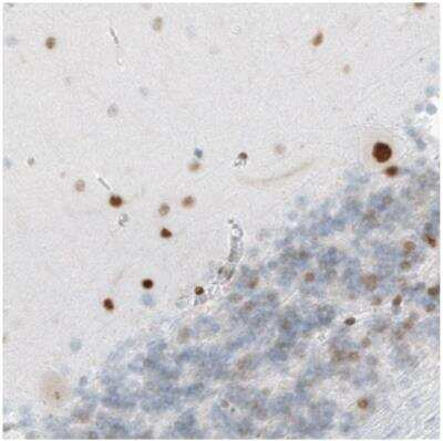 Immunohistochemistry: MEF2C Antibody (CL0369) [NBP2-30671]