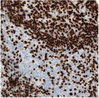 Immunohistochemistry: MEF2C Antibody (CL0369) [NBP2-30671]