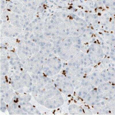 Immunohistochemistry: MEF2C Antibody (CL0369) [NBP2-30671]