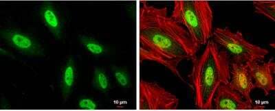 Immunocytochemistry/ Immunofluorescence: MEF2C Antibody [NBP2-17260]