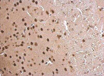 Immunohistochemistry-Paraffin: MEF2C Antibody [NBP2-17260]