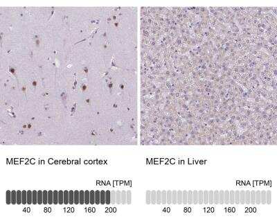 Immunohistochemistry-Paraffin: MEF2C Antibody [NBP1-89468]