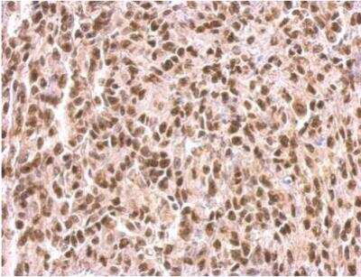Immunohistochemistry-Paraffin: MEF2C Antibody [NBP2-17260]