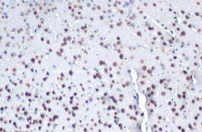 Immunohistochemistry-Paraffin: MEF2C Antibody [NBP2-17260]