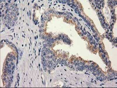 Immunohistochemistry: MEF2C Antibody (OTI1H5) - Azide and BSA Free [NBP2-72627]