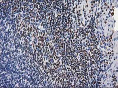 Immunohistochemistry: MEF2C Antibody (OTI1H5) - Azide and BSA Free [NBP2-72627]