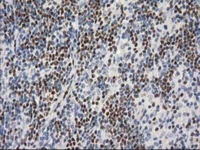 Immunohistochemistry: MEF2C Antibody (OTI1H5) - Azide and BSA Free [NBP2-72627]