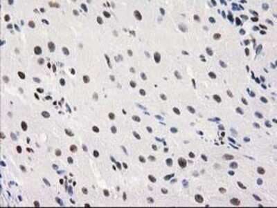 Immunohistochemistry: MEF2C Antibody (OTI1H5) - Azide and BSA Free [NBP2-72627]