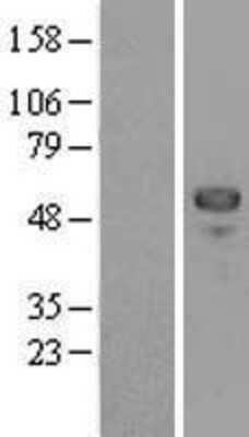 Western Blot: MEF2C Overexpression Lysate [NBL1-12999]