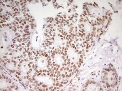 Immunohistochemistry: MEF2D Antibody (OTI1E11) [NBP2-45812]