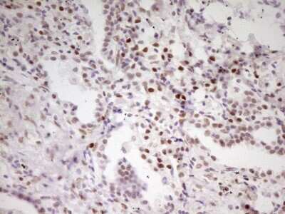 Immunohistochemistry: MEF2D Antibody (OTI1E11) [NBP2-45812]