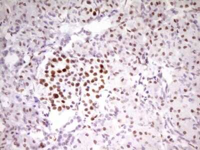 Immunohistochemistry: MEF2D Antibody (OTI1E11) [NBP2-45812]