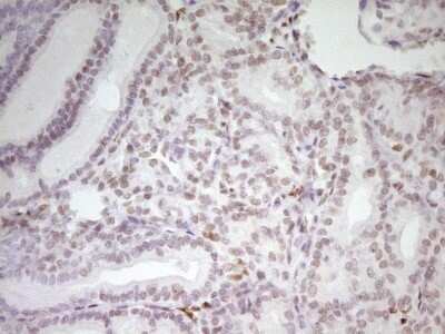 Immunohistochemistry: MEF2D Antibody (OTI1E11) [NBP2-45812]