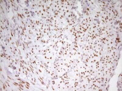Immunohistochemistry: MEF2D Antibody (OTI1E11) [NBP2-45812]