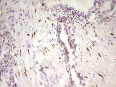 Immunohistochemistry: MEF2D Antibody (OTI1E11) [NBP2-45812]