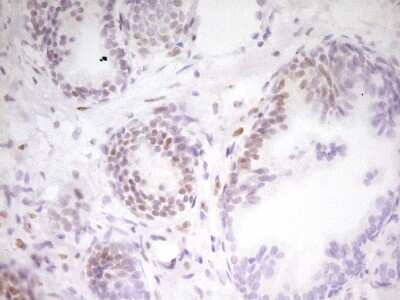 Immunohistochemistry: MEF2D Antibody (OTI1E11) [NBP2-45812]