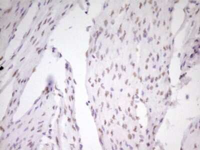 Immunohistochemistry: MEF2D Antibody (OTI1E11) [NBP2-45812]