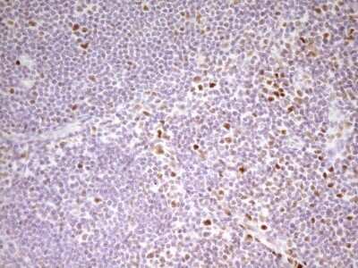 Immunohistochemistry: MEF2D Antibody (OTI1E11) [NBP2-45812]