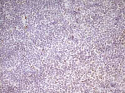 Immunohistochemistry: MEF2D Antibody (OTI1E11) [NBP2-45812]
